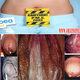 Illustration for article titled Penis saya keluar nanah dan kencing terasa panas terbakar